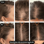 Cirogen® Haarsupplement tegen Haaruitval
