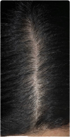 Samira na 4 maanden gebruik