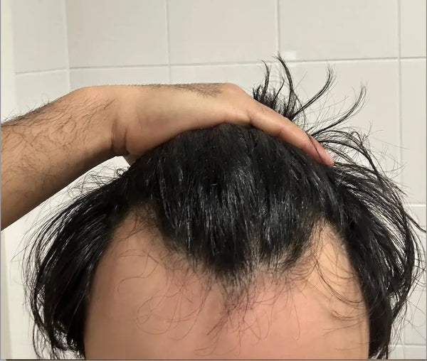 Ryan voor gebruik Cirogen