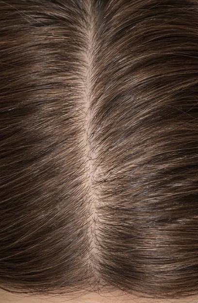 Zoë na 4 maanden gebruik